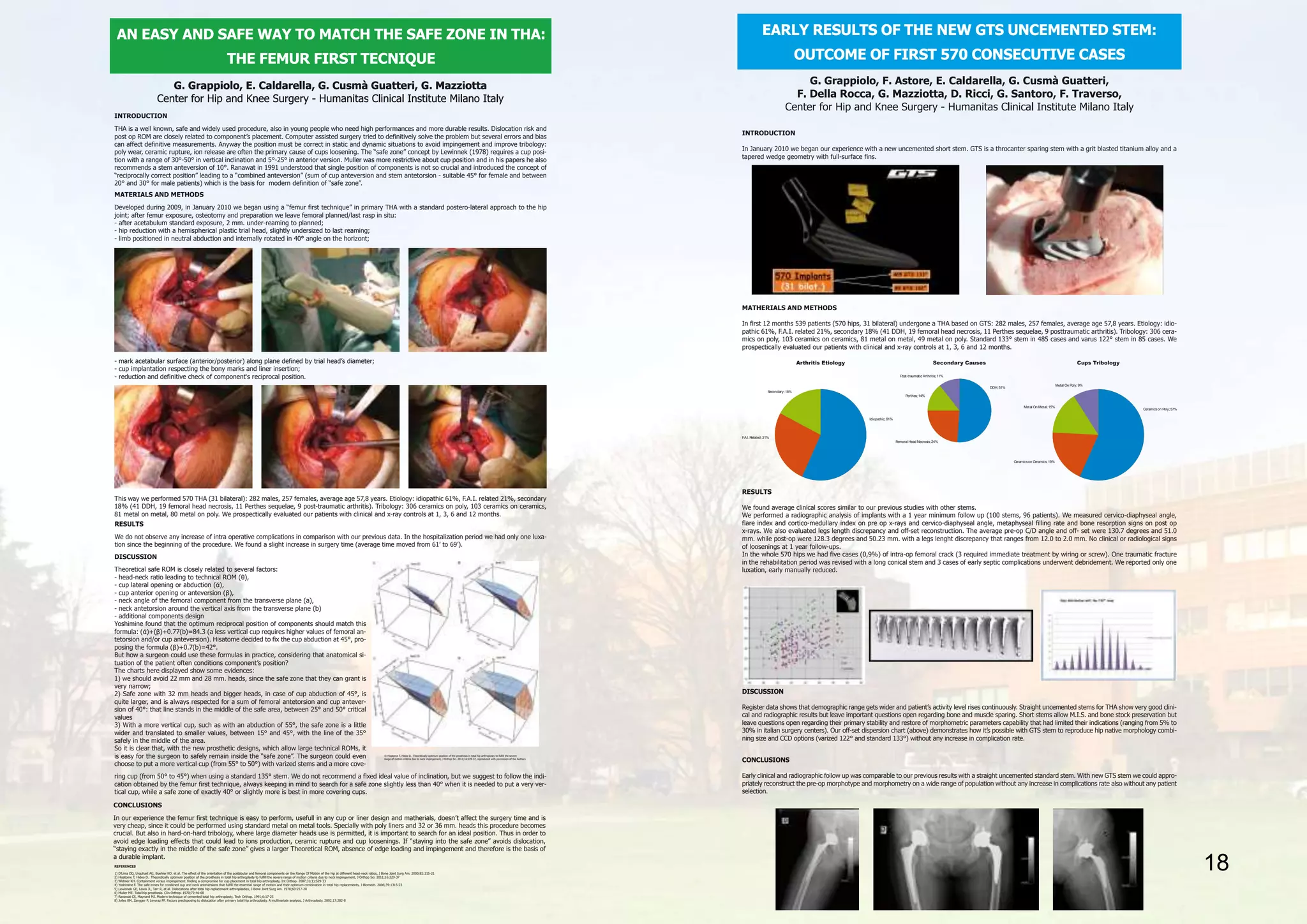 CONCLUSIONS
In our experience the femur first technique is easy to perform, usefull in any cup or liner design and matherials, doesn’t affect the surgery time and is
very cheap, since it could be performed using standard metal on metal tools. Specially with poly liners and 32 or 36 mm. heads this procedure becomes
crucial. But also in hard-on-hard tribology, where large diameter heads use is permitted, it is important to search for an ideal position. Thus in order to
avoid edge loading effects that could lead to ions production, ceramic rupture and cup loosenings. If “staying into the safe zone” avoids dislocation,
“staying exactly in the middle of the safe zone” gives a larger Theoretical ROM, absence of edge loading and impingement and therefore is the basis of
a durable implant.
DISCUSSION
Theoretical safe ROM is closely related to several factors:
- head-neck ratio leading to technical ROM (θ),
- cup lateral opening or abduction (ά),
- cup anterior opening or anteversion (β),
- neck angle of the femoral component from the transverse plane (a),
- neck antetorsion around the vertical axis from the transverse plane (b)
- additional components design
Yoshimine found that the optimum reciprocal position of components should match this
formula: (ά)+(β)+0.77(b)=84.3 (a less vertical cup requires higher values of femoral an-
tetorsion and/or cup anteversion). Hisatome decided to fix the cup abduction at 45°, pro-
posing the formula (β)+0.7(b)=42°.
But how a surgeon could use these formulas in practice, considering that anatomical si-
tuation of the patient often conditions component’s position?
The charts here displayed show some evidences:
1) we should avoid 22 mm and 28 mm. heads, since the safe zone that they can grant is
very narrow;
2) Safe zone with 32 mm heads and bigger heads, in case of cup abduction of 45°, is
quite larger, and is always respected for a sum of femoral antetorsion and cup antever-
sion of 40°: that line stands in the middle of the safe area, between 25° and 50° critical
values
3) With a more vertical cup, such as with an abduction of 55°, the safe zone is a little
wider and translated to smaller values, between 15° and 45°, with the line of the 35°
safely in the middle of the area.
So it is clear that, with the new prosthetic designs, which allow large technical ROMs, it
is easy for the surgeon to safely remain inside the “safe zone”. The surgeon could even
choose to put a more vertical cup (from 55° to 50°) with varized stems and a more cove-
ring cup (from 50° to 45°) when using a standard 135° stem. We do not recommend a fixed ideal value of inclination, but we suggest to follow the indi-
cation obtained by the femur first technique, always keeping in mind to search for a safe zone slightly less than 40° when it is needed to put a very ver-
tical cup, while a safe zone of exactly 40° or slightly more is best in more covering cups.
© Hisatome T, Hideo D. Theoretically optimum position of the prosthesis in total hip arthroplasty to fulfill the severe
range of motion criteria due to neck impingement, J Orthop Sci. 2011;16:229-37, reproduced with permission of the Authors
RESULTS
We do not observe any increase of intra operative complications in comparison with our previous data. In the hospitalization period we had only one luxa-
tion since the beginning of the procedure. We found a slight increase in surgery time (average time moved from 61’ to 69’).
REFERENCES
1) D’Lima DD, Urquhart AG, Buehler KO, et al. The effect of the orientation of the acetabular and femoral components on the Range Of Motion of the hip at different head-neck ratios, J Bone Joint Surg Am. 2000;82:315-21
2) Hisatome T, Hideo D. Theoretically optimum position of the prosthesis in total hip arthroplasty to fulfill the severe range of motion criteria due to neck impingement, J Orthop Sci. 2011;16:229-37
3) Widmer KH. Containment versus impingement: finding a compromise for cup placement in total hip arthroplasty, Int Orthop. 2007;31(1):S29-33
4) Yoshimine F. The safe-zones for combined cup and neck anteversions that fulfill the essential range of motion and their optimum combination in total hip replacements, J Biomech. 2006;39:1315-23
5) Lewinnek GE, Lewis JL, Tarr R, et al. Dislocations after total hip-replacement arthroplasties, J Bone Joint Surg Am. 1978;60:217-20
6) Muller ME. Total hip prosthesis. Clin Orthop. 1970;72:46-68
7) Ranawat CS, Maynard MJ. Modern technique of cemented total hip arthroplasty, Tech Orthop. 1991;6:17-25
8) Jolles BM, Zangger P, Leyvraz PF. Factors predisposing to dislocation after primary total hip arthroplasty. A multivariate analysis, J Arthroplasty. 2002;17:282-8
This way we performed 570 THA (31 bilateral): 282 males, 257 females, average age 57,8 years. Etiology: idiopathic 61%, F.A.I. related 21%, secondary
18% (41 DDH, 19 femoral head necrosis, 11 Perthes sequelae, 9 post-traumatic arthritis). Tribology: 306 ceramics on poly, 103 ceramics on ceramics,
81 metal on metal, 80 metal on poly. We prospectically evaluated our patients with clinical and x-ray controls at 1, 3, 6 and 12 months.
- mark acetabular surface (anterior/posterior) along plane defined by trial head’s diameter;
- cup implantation respecting the bony marks and liner insertion;
- reduction and definitive check of component‘s reciprocal position.
MATERIALS AND METHODS
Developed during 2009, in January 2010 we began using a “femur first technique” in primary THA with a standard postero-lateral approach to the hip
joint; after femur exposure, osteotomy and preparation we leave femoral planned/last rasp in situ:
- after acetabulum standard exposure, 2 mm. under-reaming to planned;
- hip reduction with a hemispherical plastic trial head, slightly undersized to last reaming;
- limb positioned in neutral abduction and internally rotated in 40° angle on the horizont;
INTRODUCTION
THA is a well known, safe and widely used procedure, also in young people who need high performances and more durable results. Dislocation risk and
post op ROM are closely related to component’s placement. Computer assisted surgery tried to definitively solve the problem but several errors and bias
can affect definitive measurements. Anyway the position must be correct in static and dynamic situations to avoid impingement and improve tribology:
poly wear, ceramic rupture, ion release are often the primary cause of cups loosening. The “safe zone” concept by Lewinnek (1978) requires a cup posi-
tion with a range of 30°-50° in vertical inclination and 5°-25° in anterior version. Muller was more restrictive about cup position and in his papers he also
recommends a stem anteversion of 10°. Ranawat in 1991 understood that single position of components is not so crucial and introduced the concept of
“reciprocally correct position” leading to a “combined anteversion” (sum of cup anteversion and stem antetorsion - suitable 45° for female and between
20° and 30° for male patients) which is the basis for modern definition of “safe zone”.
18
CONCLUSIONS
Early clinical and radiographic follow up was comparable to our previous results with a straight uncemented standard stem. With new GTS stem we could appro-
priately reconstruct the pre-op morphotype and morphometry on a wide range of population without any increase in complications rate also without any patient
selection.
DISCUSSION
Register data shows that demographic range gets wider and patient’s activity level rises continuously. Straight uncemented stems for THA show very good clini-
cal and radiographic results but leave important questions open regarding bone and muscle sparing. Short stems allow M.I.S. and bone stock preservation but
leave questions open regarding their primary stability and restore of morphometric parameters capability that had limited their indications (ranging from 5% to
30% in italian surgery centers). Our off-set dispersion chart (above) demonstrates how it’s possible with GTS stem to reproduce hip native morphology combi-
ning size and CCD options (varized 122° and standard 133°) without any increase in complication rate.
RESULTS
We found average clinical scores similar to our previous studies with other stems.
We performed a radiographic analysis of implants with a 1 year minimum follow up (100 stems, 96 patients). We measured cervico-diaphyseal angle,
flare index and cortico-medullary index on pre op x-rays and cervico-diaphyseal angle, metaphyseal filling rate and bone resorption signs on post op
x-rays. We also evaluated legs length discrepancy and off-set reconstruction. The average pre-op C/D angle and off- set were 130.7 degrees and 51.0
mm. while post-op were 128.3 degrees and 50.23 mm. with a legs lenght discrepancy that ranges from 12.0 to 2.0 mm. No clinical or radiological signs
of loosenings at 1 year follow-ups.
In the whole 570 hips we had five cases (0,9%) of intra-op femoral crack (3 required immediate treatment by wiring or screw). One traumatic fracture
in the rehabilitation period was revised with a long conical stem and 3 cases of early septic complications underwent debridement. We reported only one
luxation, early manually reduced.
Arthritis Etiology
Secondary;18%
F.A.I.Related;21%
Idiopathic;61%
Secondary Causes
Post-traumatic Arthritis;11%
Perthes;14%
Femoral Head Necrosis;24%
DDH;51%
Cups Tribology
Metal On Poly;9%
Metal On Metal;15%
Ceramicson Ceramics;19%
Ceramicson Poly;57%
MATHERIALS AND METHODS
In first 12 months 539 patients (570 hips, 31 bilateral) undergone a THA based on GTS: 282 males, 257 females, average age 57,8 years. Etiology: idio-
pathic 61%, F.A.I. related 21%, secondary 18% (41 DDH, 19 femoral head necrosis, 11 Perthes sequelae, 9 posttraumatic arthritis). Tribology: 306 cera-
mics on poly, 103 ceramics on ceramics, 81 metal on metal, 49 metal on poly. Standard 133° stem in 485 cases and varus 122° stem in 85 cases. We
prospectically evaluated our patients with clinical and x-ray controls at 1, 3, 6 and 12 months.
INTRODUCTION
In January 2010 we began our experience with a new uncemented short stem. GTS is a throcanter sparing stem with a grit blasted titanium alloy and a
tapered wedge geometry with full-surface fins.
EARLY RESULTS OF THE NEW GTS UNCEMENTED STEM:
OUTCOME OF FIRST 570 CONSECUTIVE CASES
 