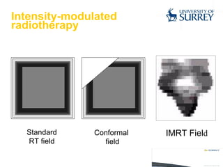 Intensity-modulated  radiotherapy Standard RT field Conformal  field IMRT Fiel d 