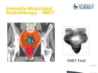 Intensity-Modulated  Radiotherapy – IMRT IMRT Field 