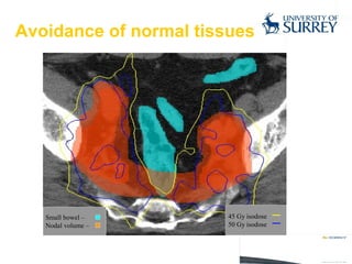Avoidance of normal tissues 