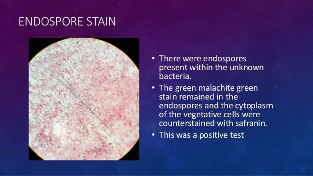 unknown project microbiology Result from the mannitol fermentation test it was decided that unknown #545 was enterococcus faecalis. unknown project microbiology Result from the mannitol fermentation test it was decided that unknown #545 was enterococcus faecalis.