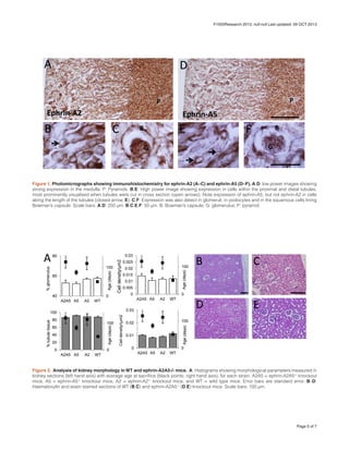Figure 1. Photomicrographs showing immunohistochemistry for ephrin-A2 (A–C) and ephrin-A5 (D–F). A,D: low power images showing
strong expression in the medulla. P: Pyramids. B,E: High power image showing expression in cells within the proximal and distal tubules,
most prominently visualised when tubules were cut in cross section (open arrows). Note expression of ephrin-A5, but not ephrin-A2 in cells
along the length of the tubules (closed arrow, E). C,F: Expression was also detect in glomeruli, in podocytes and in the squamous cells lining
Bowman’s capsule. Scale bars: A,D: 250 µm; B,C,E,F: 50 µm. B: Bowman’s capsule; G: glomerulus; P: pyramid.
Figure 2. Analysis of kidney morphology in WT and ephrin-A2A5-/- mice. A: Histograms showing morphological parameters measured in
kidney sections (left hand axis) with average age at sacrifice (black points; right hand axis), for each strain. A2A5 = ephrin-A2A5-/-
knockout
mice, A5 = ephrin-A5-/-
knockout mice, A2 = ephrin-A2-/-
knockout mice, and WT = wild type mice. Error bars are standard error. B–D:
Haematoxylin and eosin stained sections of WT (B,C) and ephrin-A2A5-/-
(D,E) knockout mice. Scale bars: 100 µm.
Page 5 of 7
F1000Research 2013, null:null Last updated: 09 OCT 2013
 