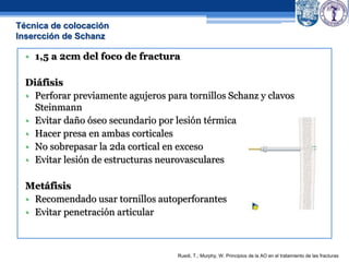 • 1,5 a 2cm del foco de fractura
Diáfisis
• Perforar previamente agujeros para tornillos Schanz y clavos
Steinmann
• Evitar daño óseo secundario por lesión térmica
• Hacer presa en ambas corticales
• No sobrepasar la 2da cortical en exceso
• Evitar lesión de estructuras neurovasculares
Metáfisis
• Recomendado usar tornillos autoperforantes
• Evitar penetración articular
Ruedi, T.; Murphy, W. Principios de la AO en el tratamiento de las fracturas
Técnica de colocación
Insercción de Schanz
 