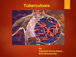 1
Tuberculosis
By
Gandholi Neeraj Kalyan
B.Sc Biosciences
 