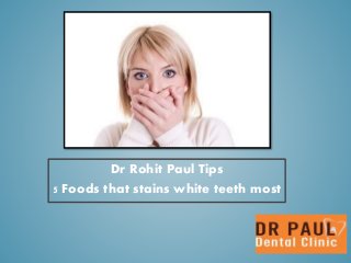 Dr Rohit Paul Tips
5 Foods that stains white teeth most
 