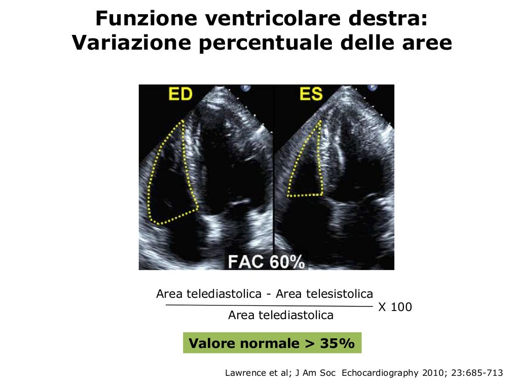 La valutazione ecocardiografica della funzione ventricolare destra