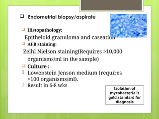 genital tb very important topic in gynaecology | PPTX
