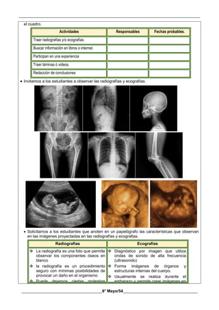 __________________________________________________________________________________________
________________________________________6° Mayo/54_____________________________________
el cuadro.
Actividades Responsables Fechas probables.
Traer radiografías y/o ecografías.
Buscar información en libros o internet.
Participan en una experiencia
Traer láminas ó videos.
Redacción de conclusiones
 Invitamos a los estudiantes a observar las radiografías y ecografías.
 Solicitamos a los estudiantes que anoten en un papelógrafo las características que observan
en las imágenes proyectadas en las radiografías y ecografias.
Radiografías Ecografías
 La radiografía es una foto que permite
observar los componentes óseos en
blanco
 la radiografía es un procedimiento
seguro con mínimas posibilidades de
provocar un daño en el organismo
 Puede dejarnos ciertas molestias
 Diagnóstico por imagen que utiliza
ondas de sonido de alta frecuencia
(ultrasonido)
 Forma imágenes de órganos y
estructuras internas del cuerpo.
 Usualmente se realiza durante el
embarazo y permite crear imágenes en
 