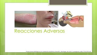 Reacciones Adversas
Proyecciones radiológicas con correlación anatómica, Kenneth L. Bontrager, MA John P. Lampignano, MEd, 7ª Ed. 2010. 461
 