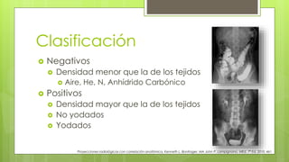 Clasificación
 Negativos
 Densidad menor que la de los tejidos
 Aire, He, N, Anhídrido Carbónico
 Positivos
 Densidad mayor que la de los tejidos
 No yodados
 Yodados
Proyecciones radiológicas con correlación anatómica, Kenneth L. Bontrager, MA John P. Lampignano, MEd, 7ª Ed. 2010. 461
 