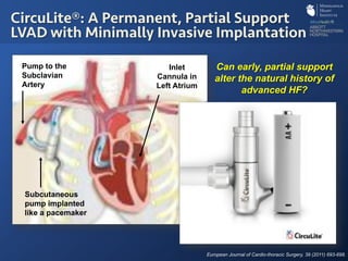 Inlet
Cannula in
Left Atrium
Pump to the
Subclavian
Artery
Subcutaneous
pump implanted
like a pacemaker
CircuLite®: A Permanent, Partial Support
LVAD with Minimally Invasive Implantation
European Journal of Cardio-thoracic Surgery, 39 (2011) 693-698.
Can early, partial support
alter the natural history of
advanced HF?
 