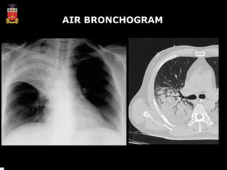Comprehensive Medical Imaging Techniques and Radiological Signs in ...