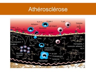Athérosclérose 