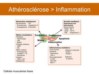 Athérosclérose > Inflammation Cellules musculaires lisses 