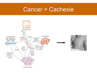 Cancer > Cachexie 