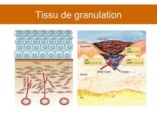 Tissu de granulation 