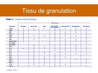 Tissu de granulation 