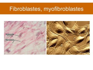 Fibroblastes, myofibroblastes 