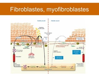 Fibroblastes, myofibroblastes 