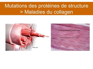 Mutations des protéines de structure > Maladies du collagen 