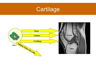 Cartilage 