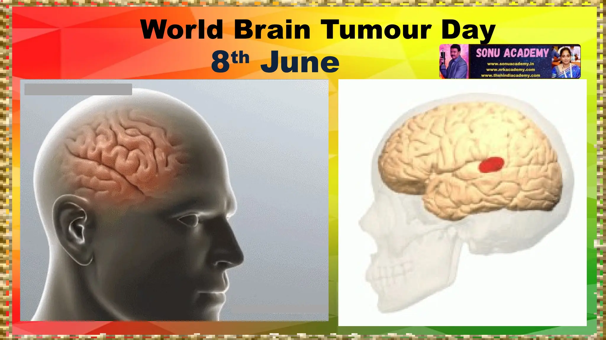 World Brain Tumour Day
8th
June
 