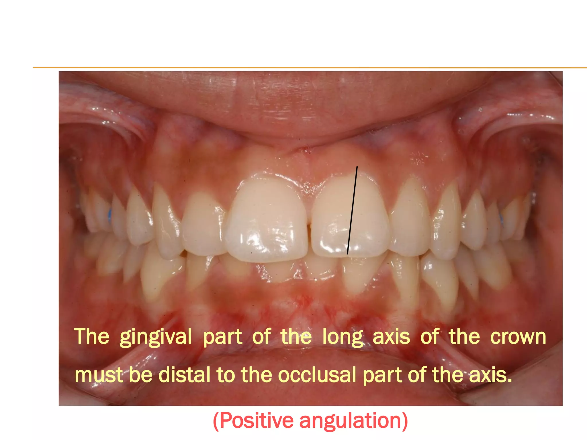 6 keys of occlusion-converted.pdf