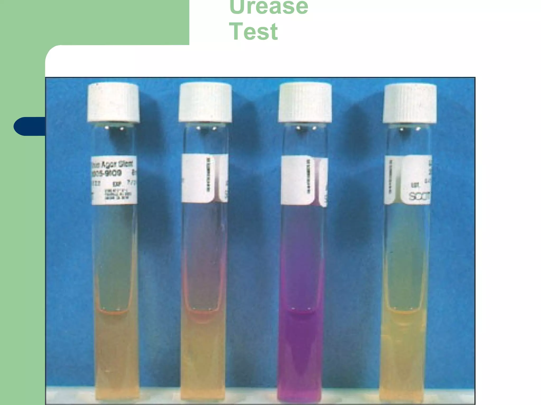 Urease
Test
 