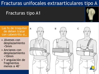 Fracturas unifocales extraarticulares tipo A
Las fx de troquiter
de deben tratar
con cabestrillo si…
• Jóvenes con
desplazamiento
<5mm
• Ancianos con
desplazamiento
<10mm
• Y angulación de
fragmentos
menos a 40°
Fracturas tipo A1
 