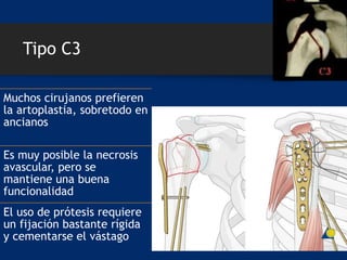 Tipo C3
Muchos cirujanos prefieren
la artoplastia, sobretodo en
ancianos
Es muy posible la necrosis
avascular, pero se
mantiene una buena
funcionalidad
El uso de prótesis requiere
un fijación bastante rígida
y cementarse el vástago
 