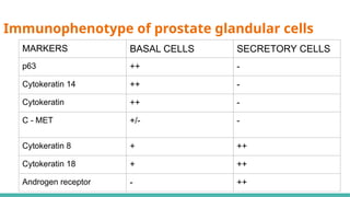Prostate Pattern D MORPHOLOGICAL PATTERNS OF PROSTATE TUMORS.pptx