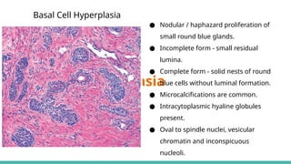 MORPHOLOGICAL PATTERNS OF PROSTATE TUMORS.pptx