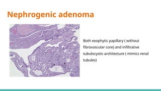 MORPHOLOGICAL PATTERNS OF PROSTATE TUMORS.pptx