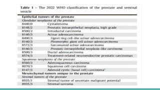 Prostate Pattern D MORPHOLOGICAL PATTERNS OF PROSTATE TUMORS.pptx
