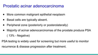 MORPHOLOGICAL PATTERNS OF PROSTATE TUMORS.pptx