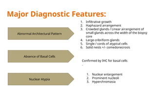 Prostate Pattern D MORPHOLOGICAL PATTERNS OF PROSTATE TUMORS.pptx