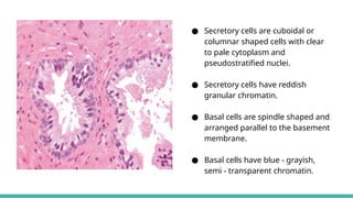 Prostate Pattern D MORPHOLOGICAL PATTERNS OF PROSTATE TUMORS.pptx