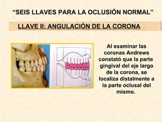“SEIS LLAVES PARA LA OCLUSIÓN NORMAL”

 LLAVE II: ANGULACIÓN DE LA CORONA


                          Al examinar las
                         coronas Andrews
                      constató que la parte
                       gingival del eje largo
                          de la corona, se
                      localiza distalmente a
                        la parte oclusal del
                              mismo.
 
