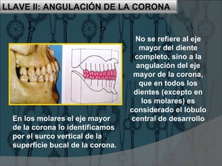 LLAVE II: ANGULACIÓN DE LA CORONA


                                    No se refiere al eje
                                      mayor del diente
                                    completo, sino a la
                                     angulación del eje
                                    mayor de la corona,
                                      que en todos los
                                    dientes (excepto en
                                       los molares) es
                                   considerado el lóbulo
  En los molares el eje mayor      central de desarrollo
  de la corona lo identificamos
  por el surco vertical de la
  superficie bucal de la corona.
 