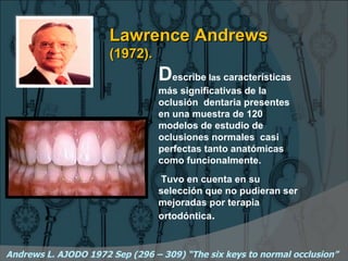 Lawrence Andrews
                      (1972).
                                 Describe las características
                                 más significativas de la
                                 oclusión dentaria presentes
                                 en una muestra de 120
                                 modelos de estudio de
                                 oclusiones normales casi
                                 perfectas tanto anatómicas
                                 como funcionalmente.
                                 Tuvo en cuenta en su
                                 selección que no pudieran ser
                                 mejoradas por terapia
                                 ortodóntica.


Andrews L. AJODO 1972 Sep (296 – 309) “The six keys to normal occlusion”
 