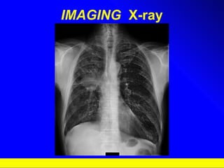 IMAGING   X-ray 