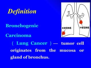 Bronchogenic  Carcinoma  （ Lung Cancer ） —  tumor cell originates from the mucosa or gland of bronchus. Definition 