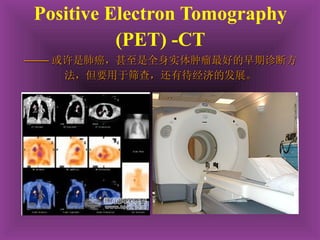 Positive Electron Tomography (PET)   -CT —— 或许是肺癌，甚至是全身实体肿瘤最好的早期诊断方法，但要用于筛查，还有待经济的发展。 