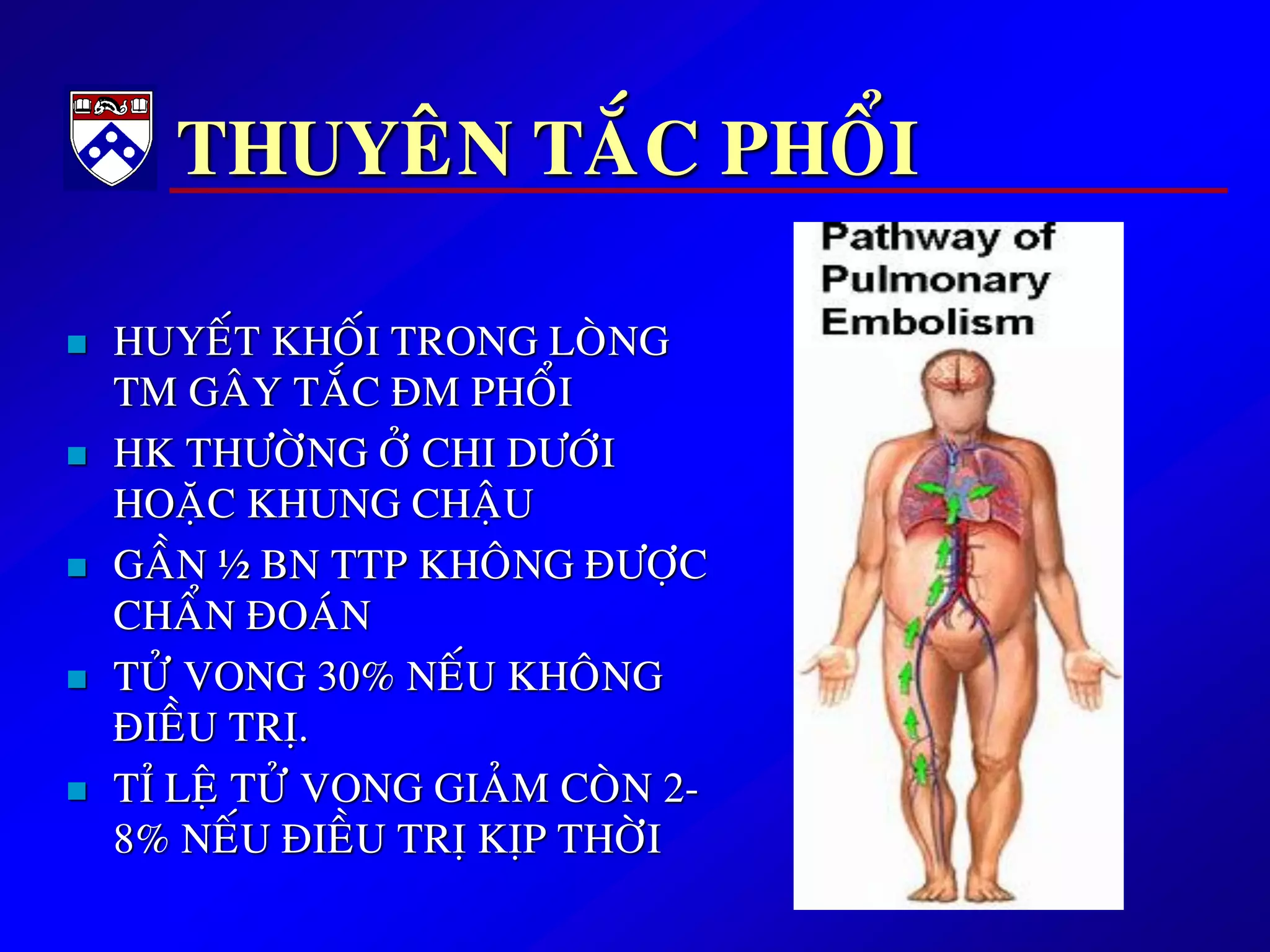 THUYEÂN TAÉC PHOÅI
 HUYEÁT KHOÁI TRONG LOØNG
TM GAÂY TAÉC ÑM PHOÅI
 HK THÖÔØNG ÔÛ CHI DÖÔÙI
HOAËC KHUNG CHAÄU
 GAÀN ½ BN TTP KHOÂNG ÑÖÔÏC
CHAÅN ÑOAÙN
 TÖÛ VONG 30% NEÁU KHOÂNG
ÑIEÀU TRÒ.
 TÆ LEÄ TÖÛ VONG GIAÛM COØN 2-
8% NEÁU ÑIEÀU TRÒ KÒP THÔØI
 
