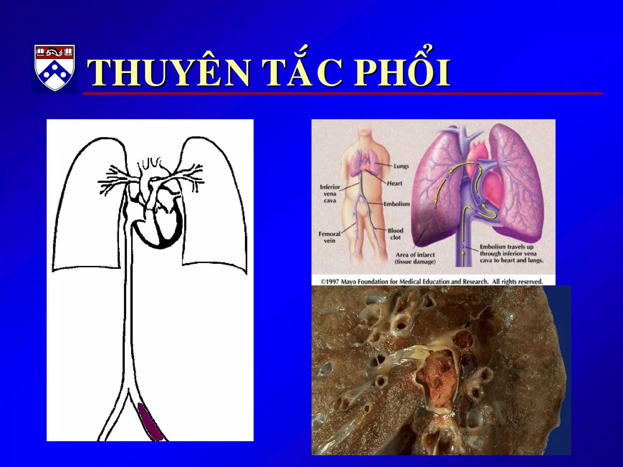THUYEÂN TAÉC PHOÅI
 