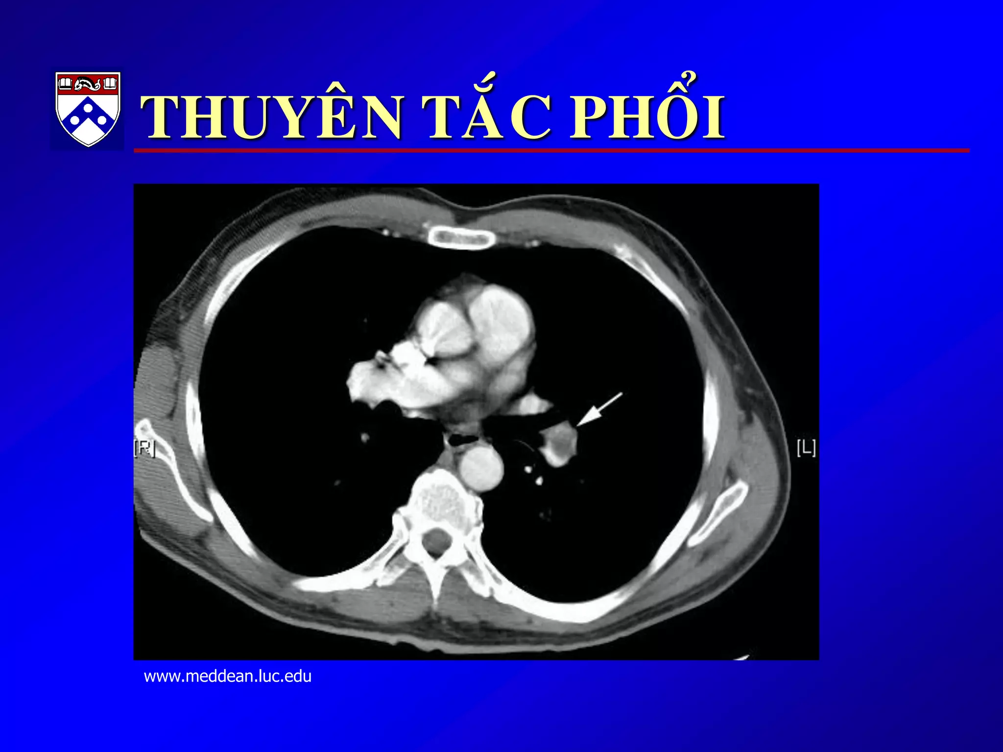 THUYEÂN TAÉC PHOÅI
www.meddean.luc.edu
 
