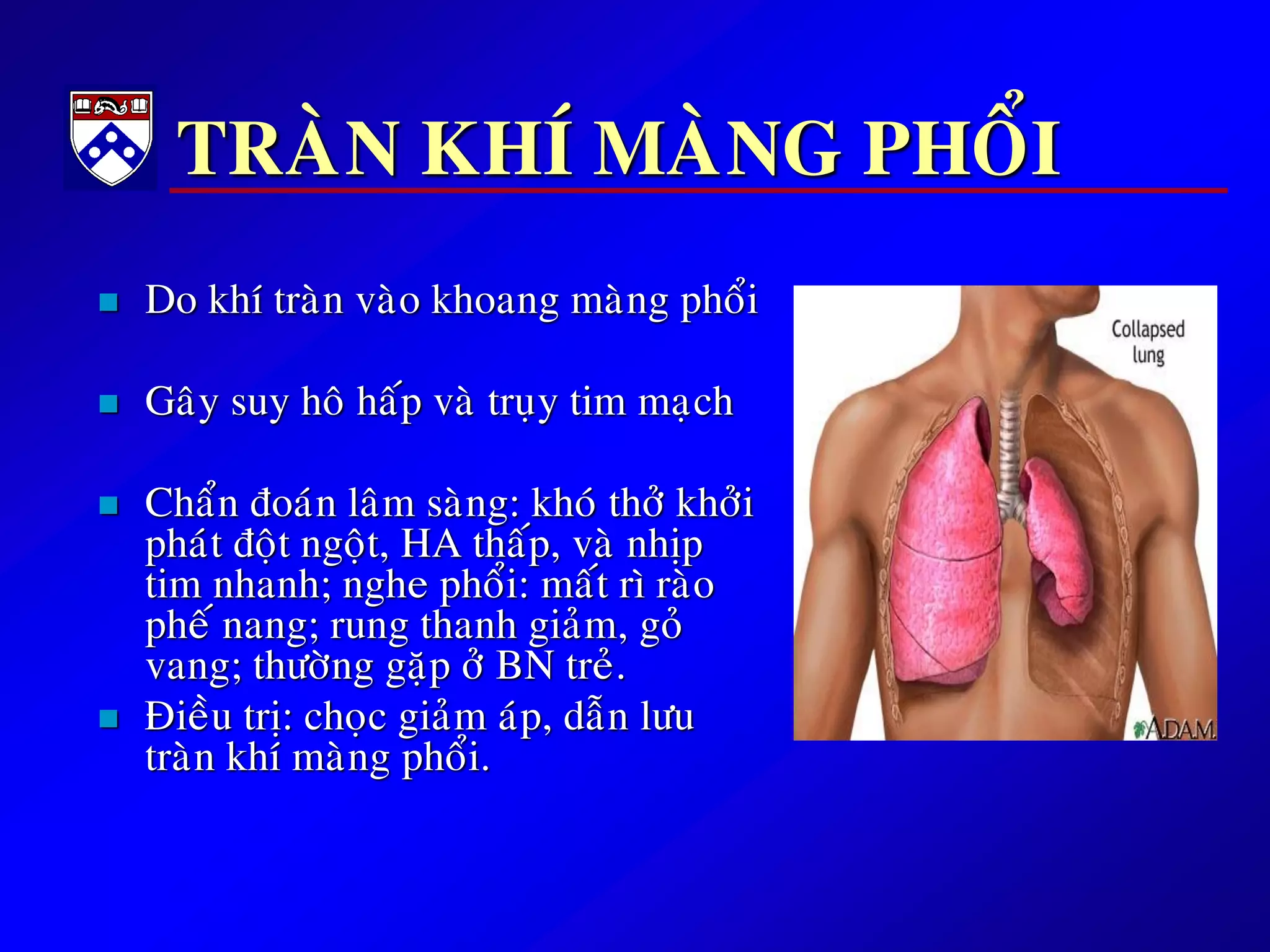 TRAØN KHÍ MAØNG PHOÅI
 Do khí traøn vaøo khoang maøng phoåi
 Gaây suy hoâ haáp vaø truïy tim maïch
 Chaån ñoaùn laâm saøng: khoù thôû khôûi
phaùt ñoät ngoät, HA thaáp, vaø nhòp
tim nhanh; nghe phoåi: maát rì raøo
pheá nang; rung thanh giaûm, goû
vang; thöôøng gaëp ôû BN treû.
 Ñieàu trò: choïc giaûm aùp, daãn löu
traøn khí maøng phoåi.
 