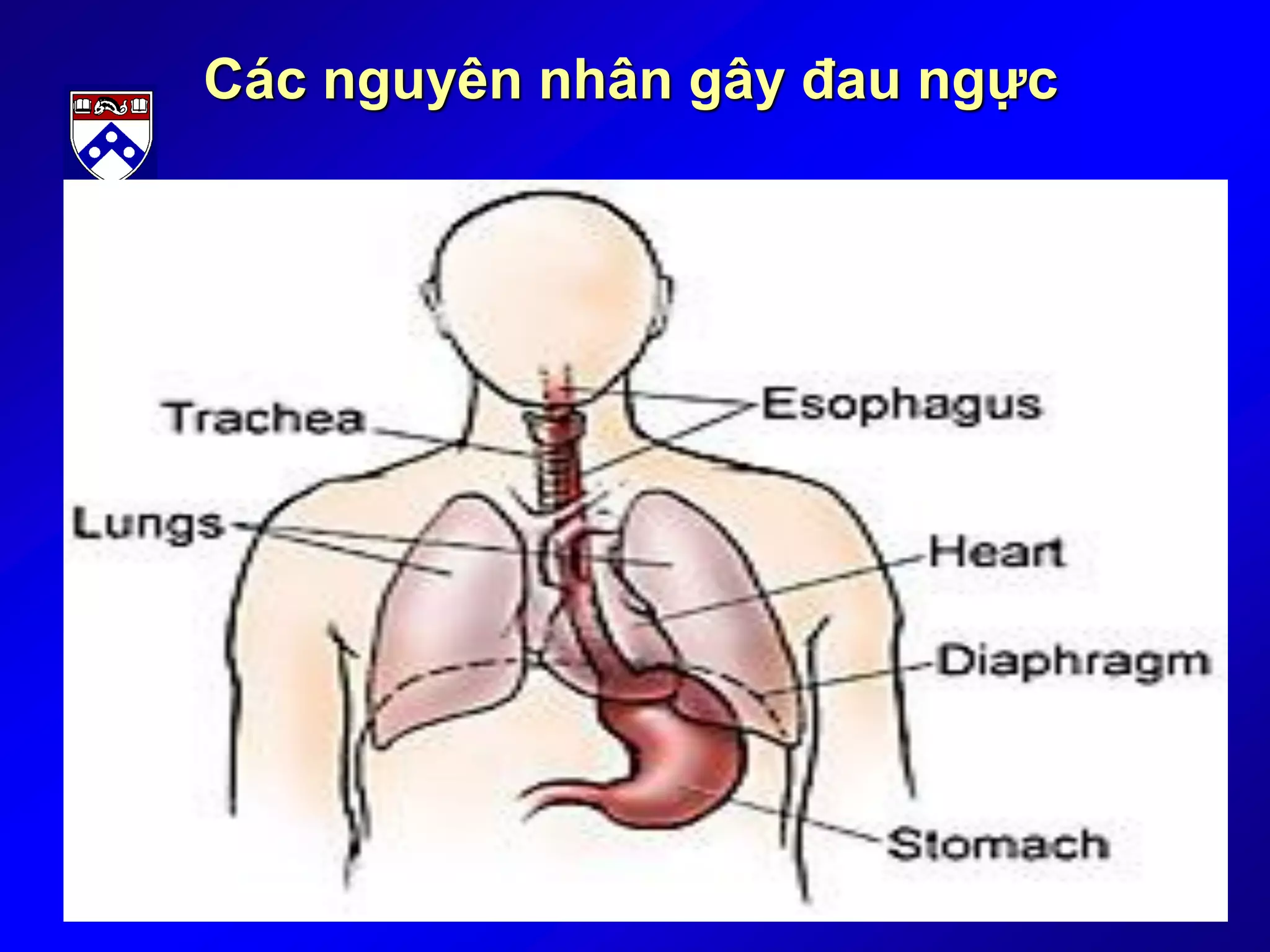 Các nguyên nhân gây đau ngực
 