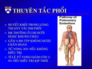 THUYEÂN TAÉC PHOÅI
 HUYEÁT KHOÁI TRONG LOØNG
TM GAÂY TAÉC ÑM PHOÅI
 HK THÖÔØNG ÔÛ CHI DÖÔÙI
HOAËC KHUNG CHAÄU
 GAÀN ½ BN TTP KHOÂNG ÑÖÔÏC
CHAÅN ÑOAÙN
 TÖÛ VONG 30% NEÁU KHOÂNG
ÑIEÀU TRÒ.
 TÆ LEÄ TÖÛ VONG GIAÛM COØN 2-
8% NEÁU ÑIEÀU TRÒ KÒP THÔØI
 