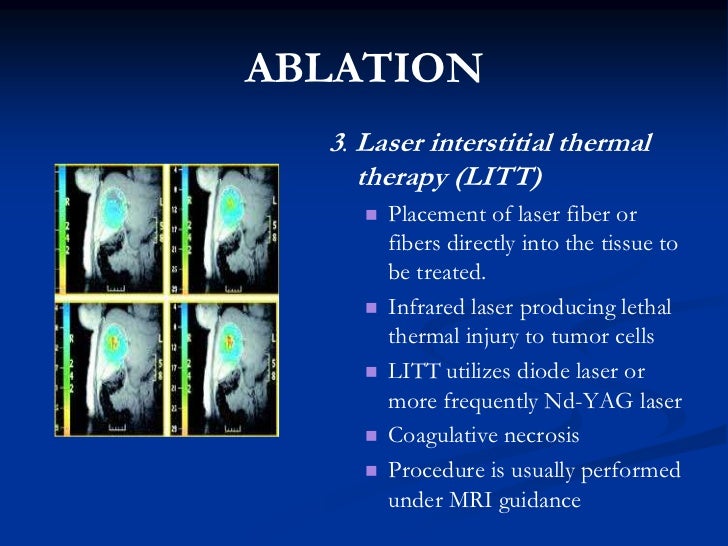 management of metastatic colorectal cancer